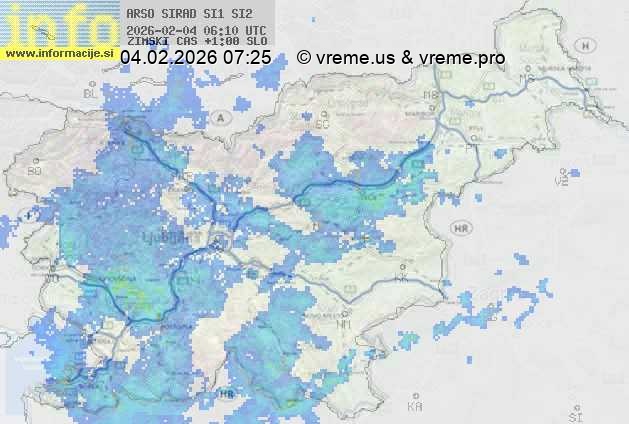 Radarska karta padavin